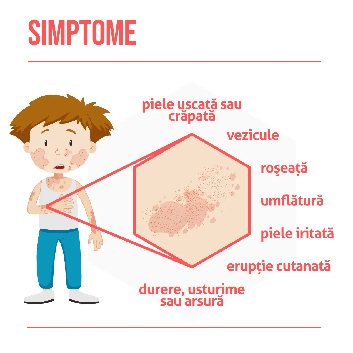 Dermatita