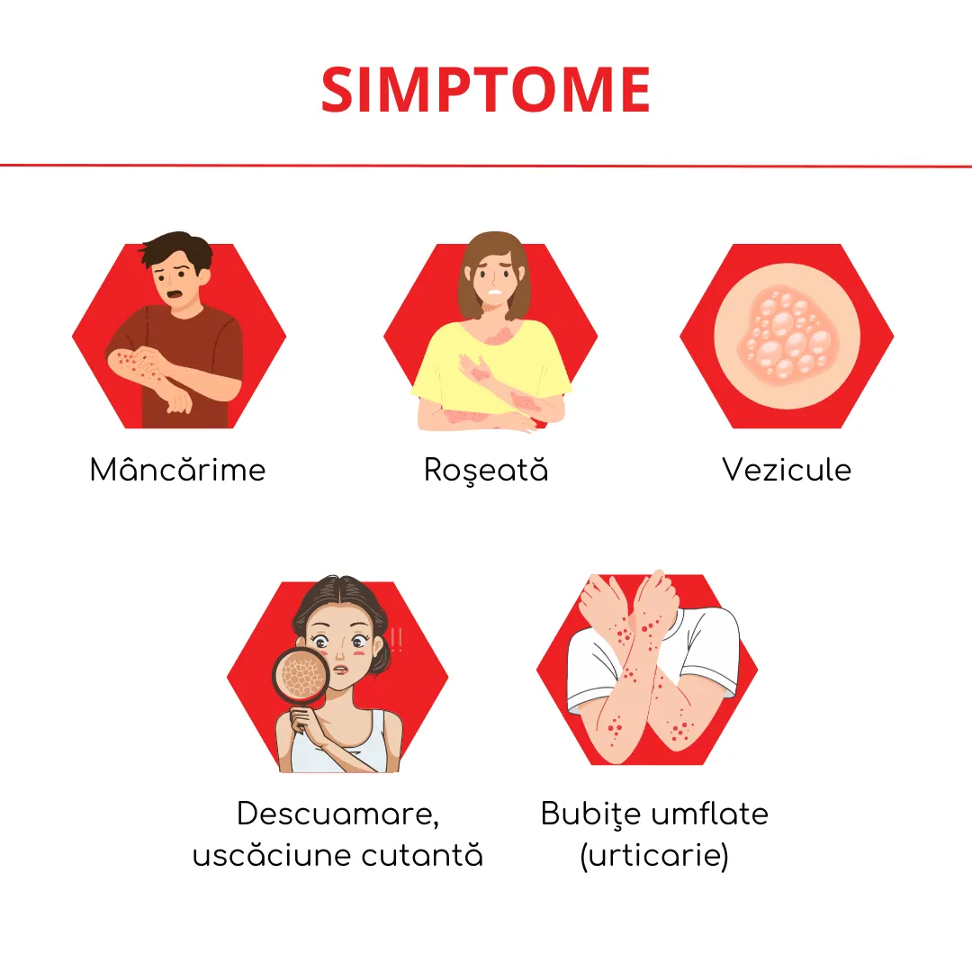 simptomele alergiilor cutanate