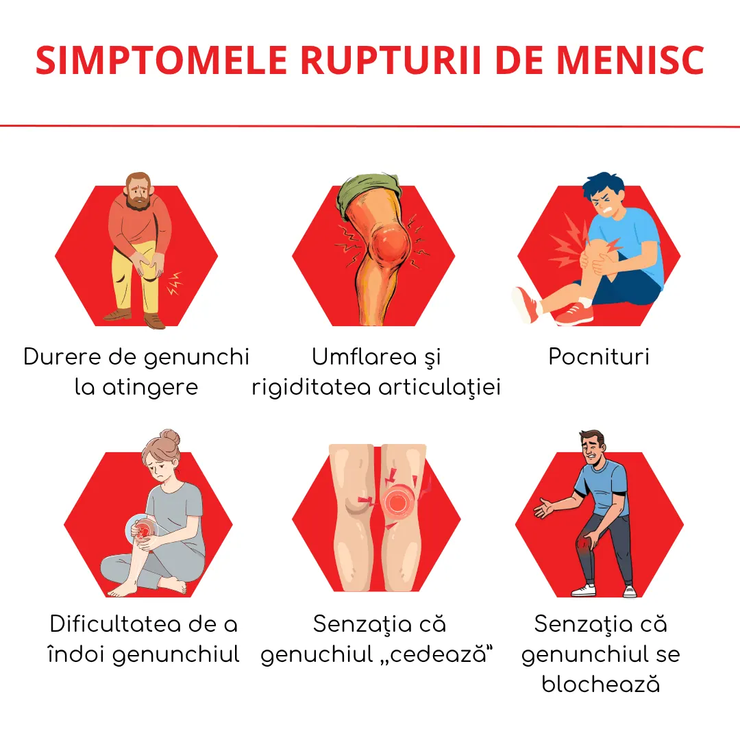 simptomele rupturii de menisc