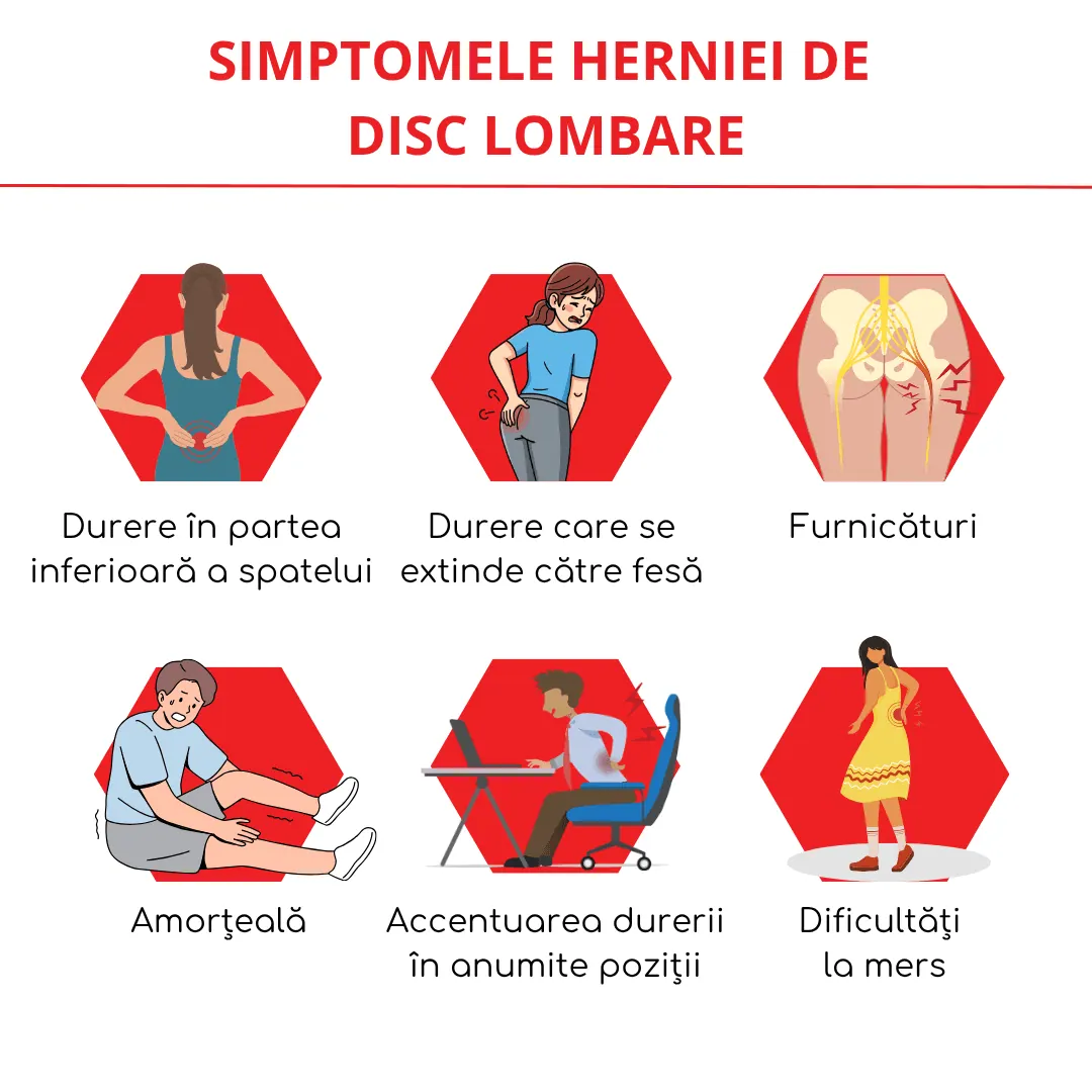 simptomele herniei de disc lombare
