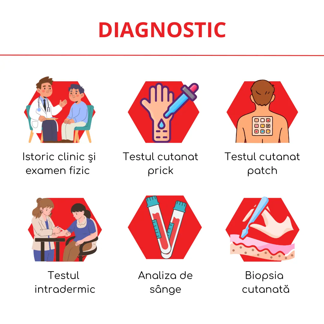 diagnosticul alergiilor cutanate