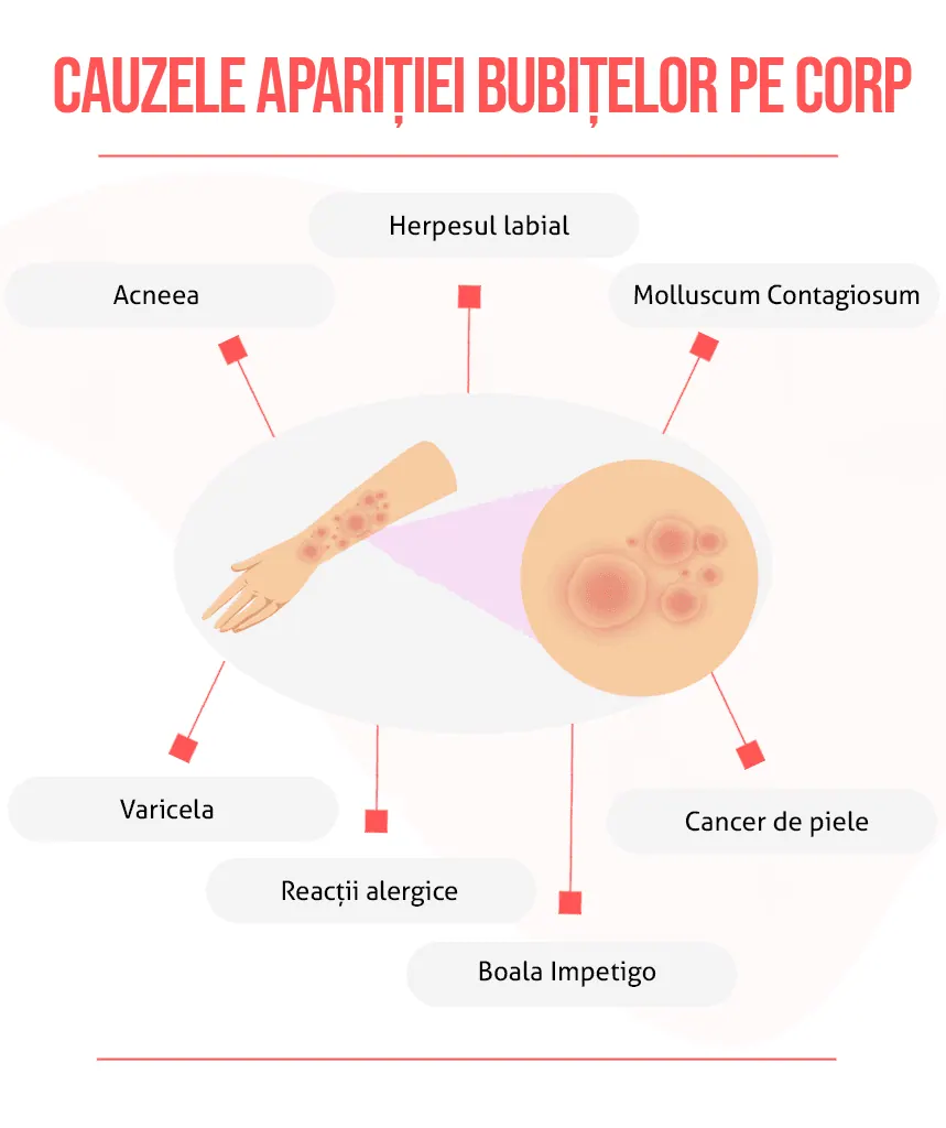Cauzele apariției bubițelor pe corp
