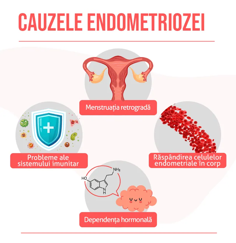 Cauze endometriozei