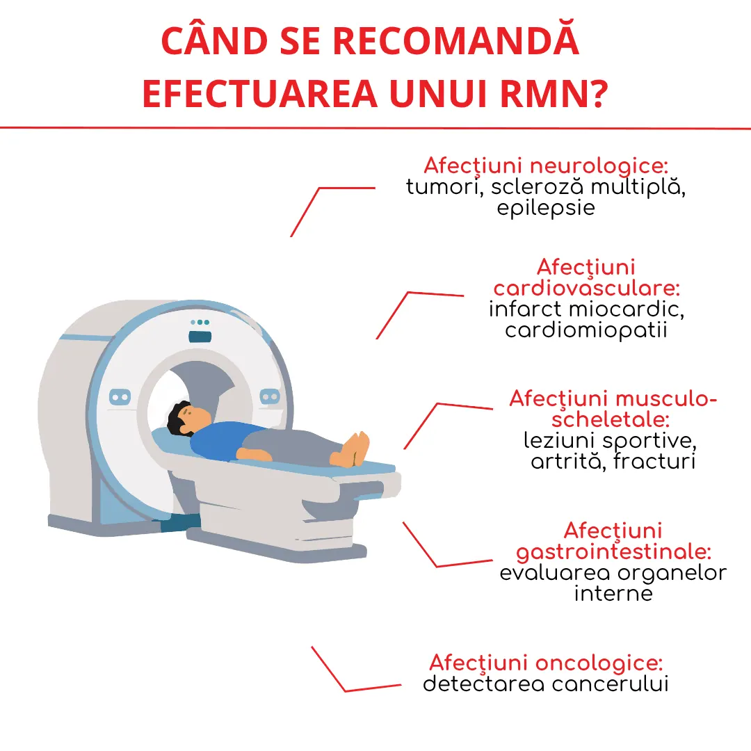 cand se recomanda efectuarea unui RMN