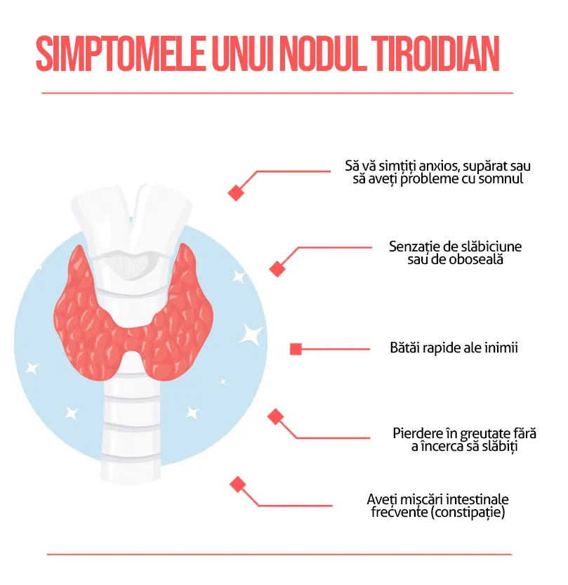 Noduli Tiroidieni