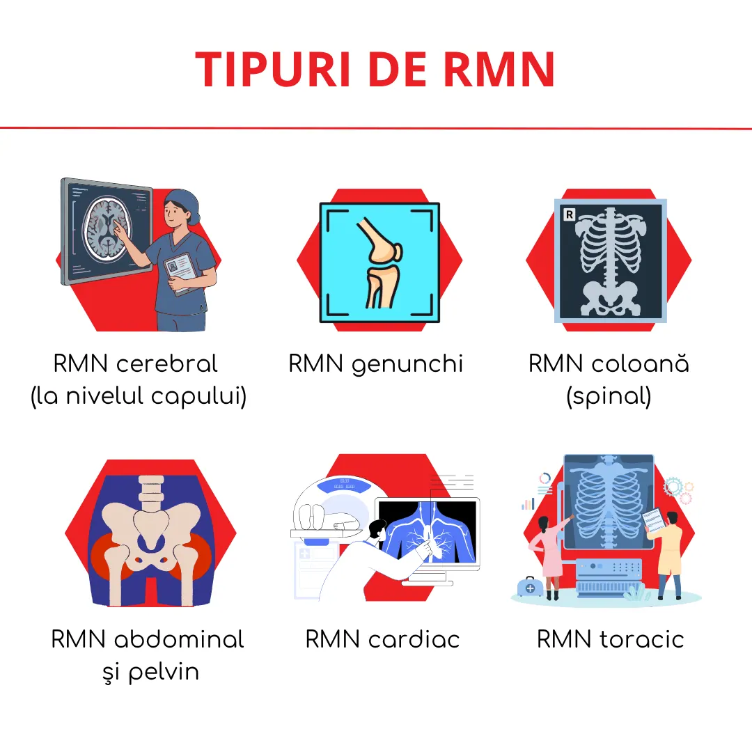 tipuri de RMN