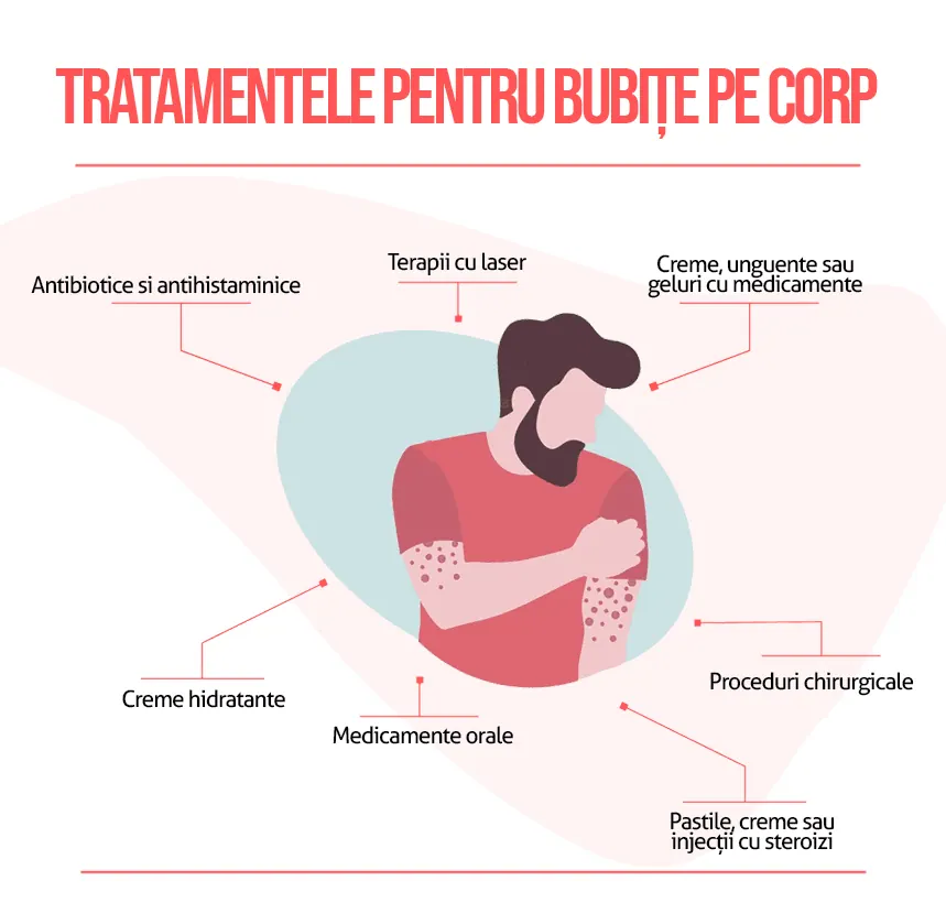 Tratamente pentru bubite pe corp